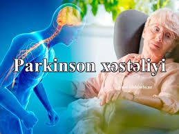 Alimlər Parkinson xəstəliyinin genetik səbəbini aşkarlayıblar