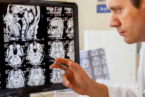 Amerikalı alimlər xərçəngə qarşı yeni immunoterapiya yaradıblar